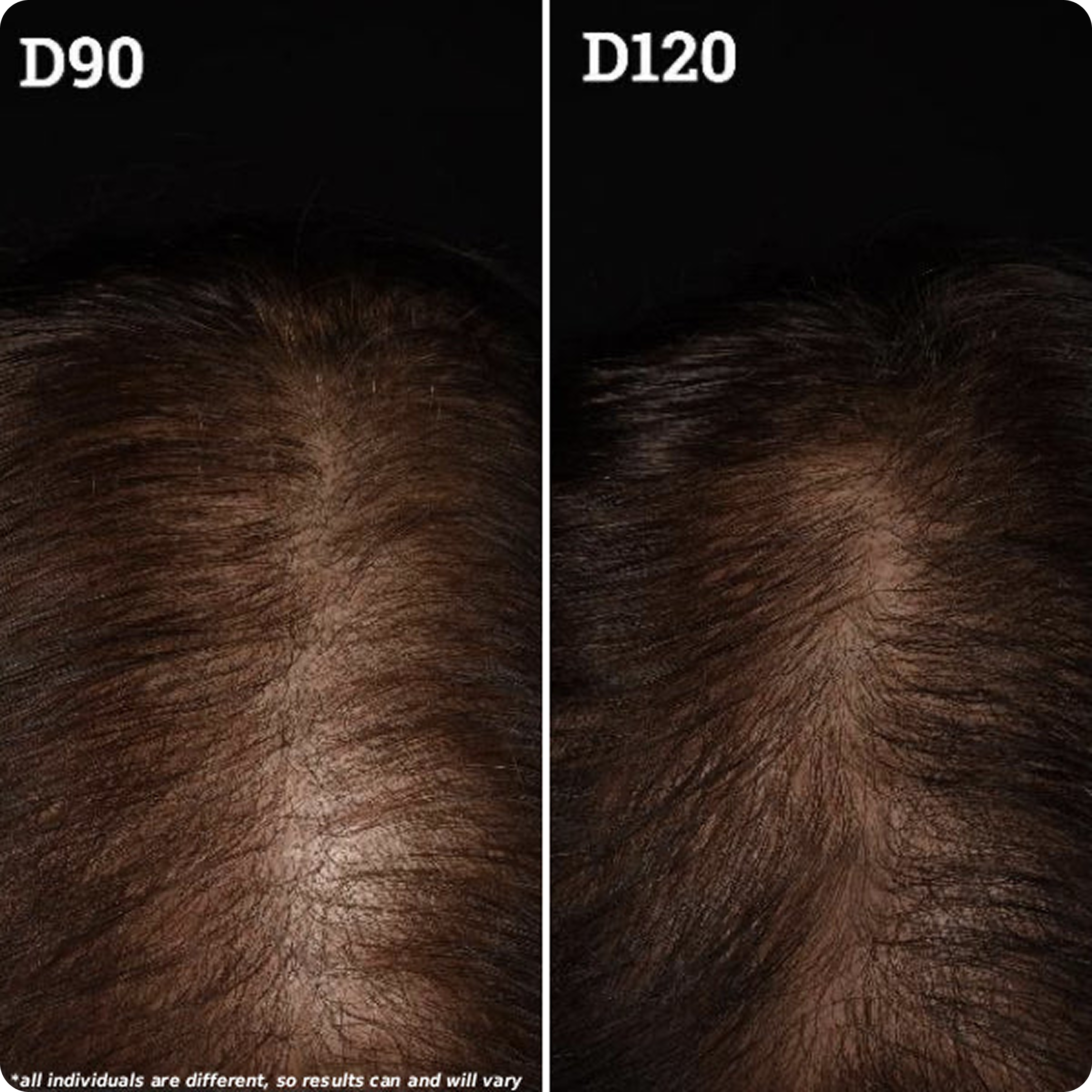 The Treatment Scalp Serum