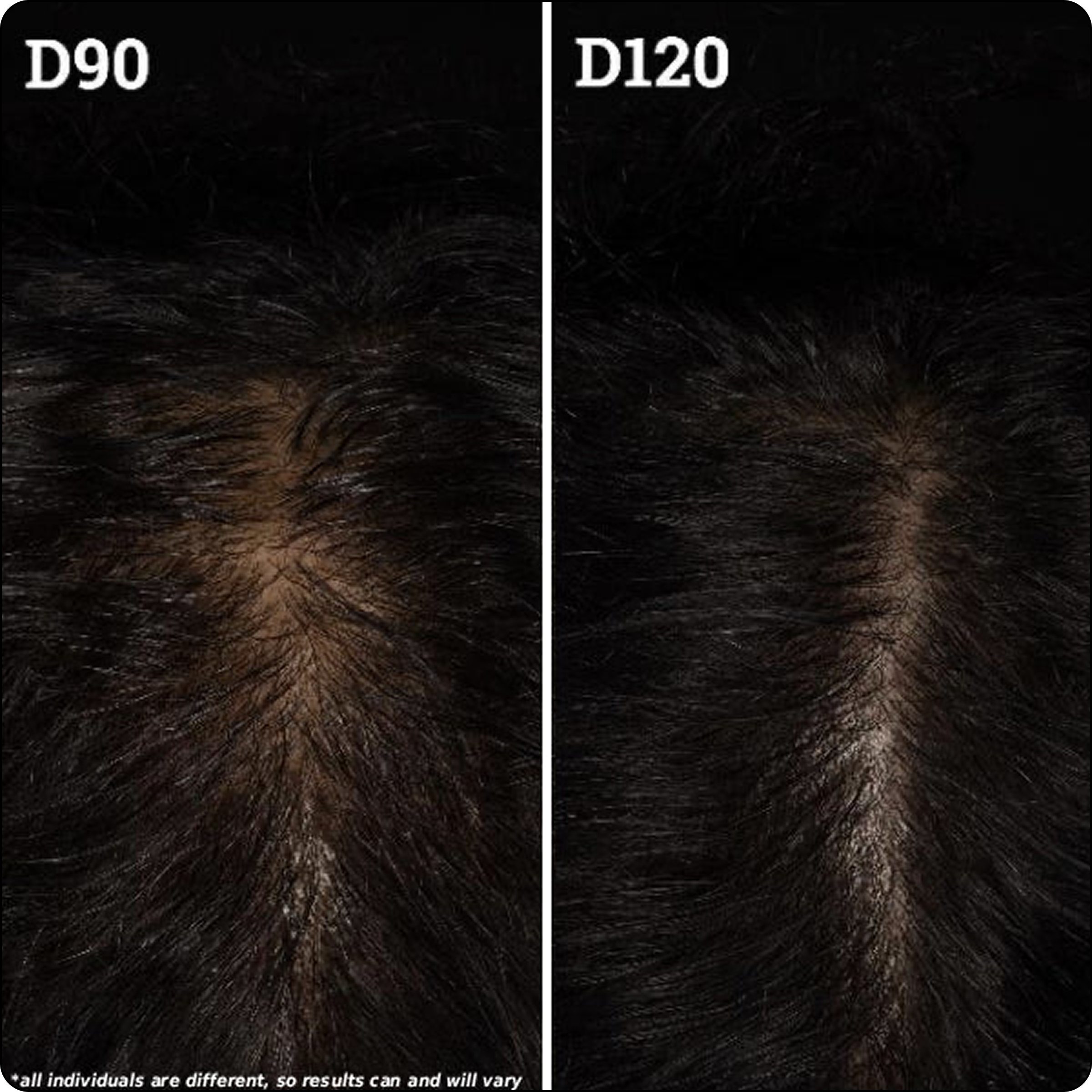 The Treatment Scalp Serum