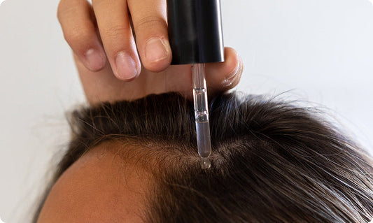 Close-up of hand applying scalp serum with dropper to parted hairline