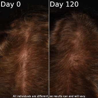 Comparison of hair texture on Day 0 and Day 120 with a disclaimer about individual results.