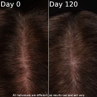 Comparison of hair texture on Day 0 and Day 120 with a disclaimer about individual results.