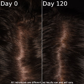 Comparison of hair texture between 'Day 0' and 'Day 120' on a dark background.