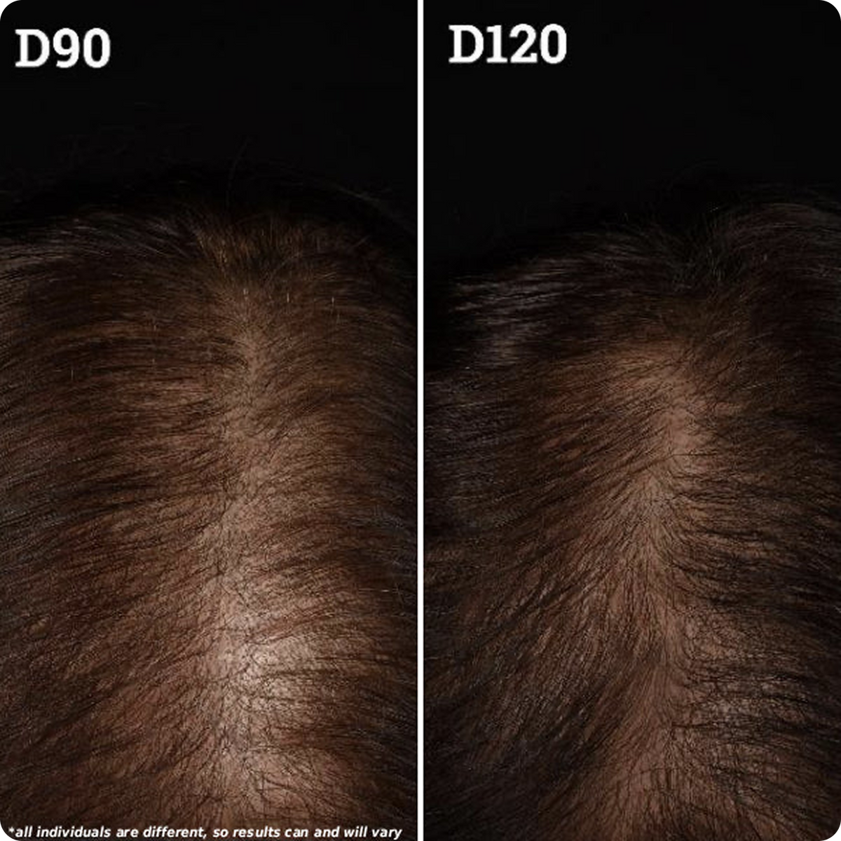 The Treatment Scalp Serum