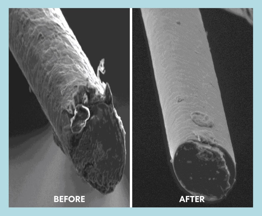Comparison of follicle texture 'Before' and 'After' on a light blue background, based on a clinical study of Kerashift V.