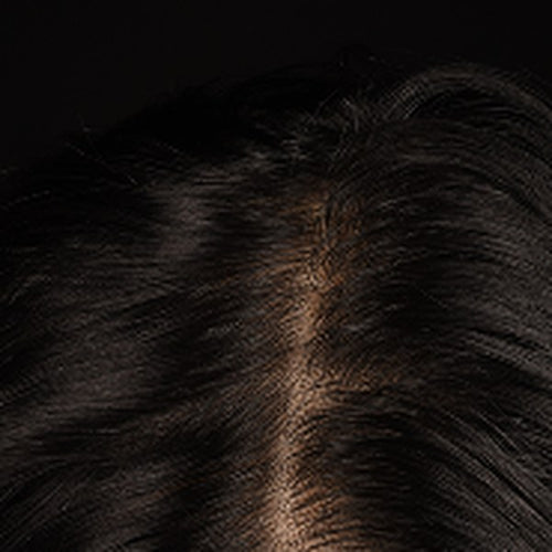 Top-down close-up of dark hair parted at the crown, revealing the scalp