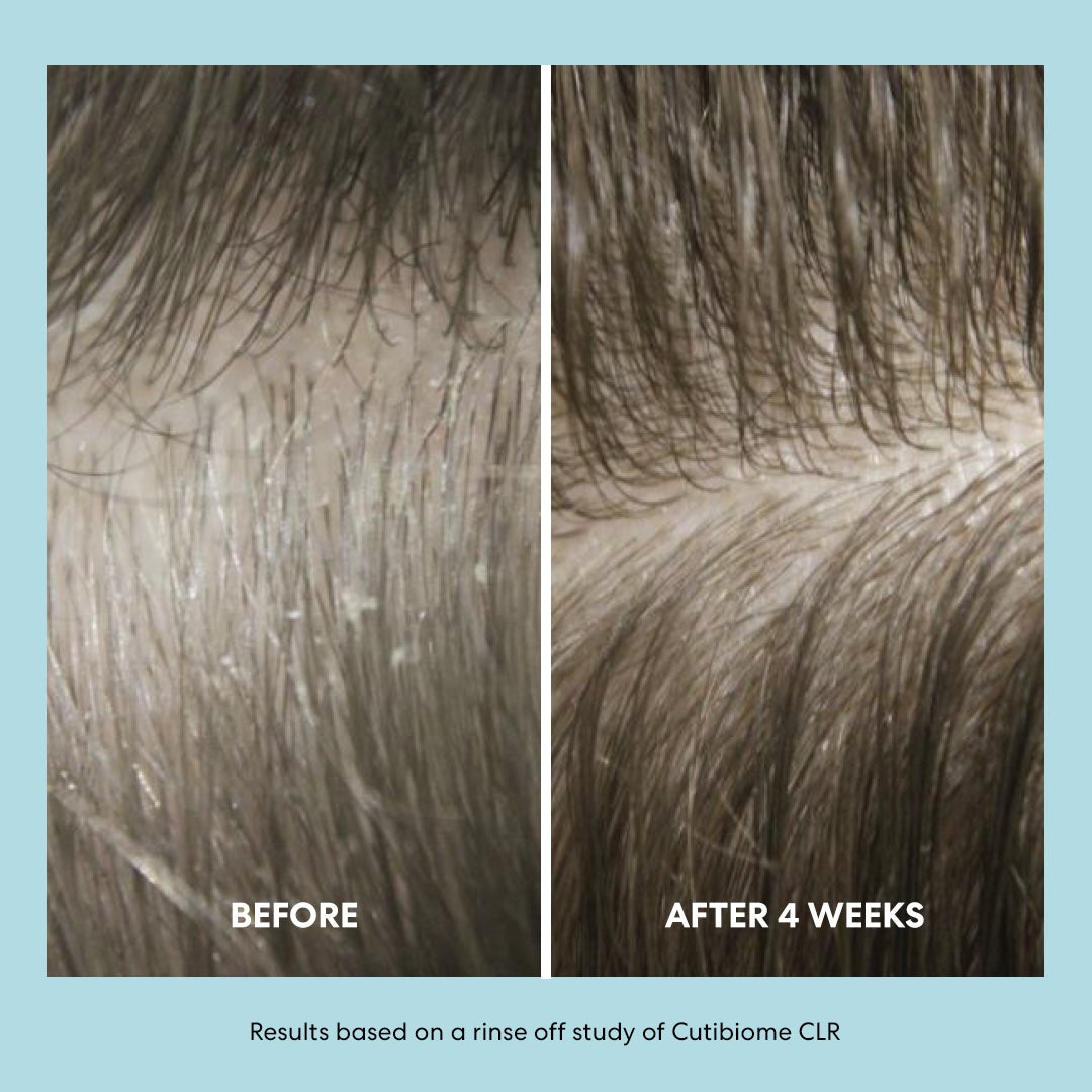 The Shampoo (Calm + Soothe) – KilgourMD