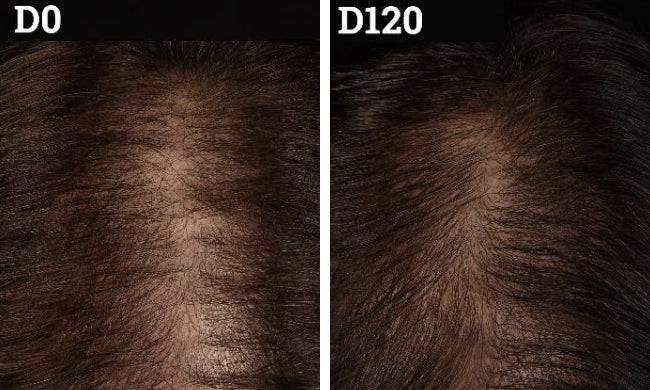 Before and after clinical example