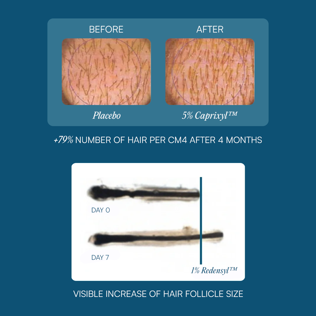 The KilgourMD Bundle | Dual-Action Scalp Serums for Thinning Hair